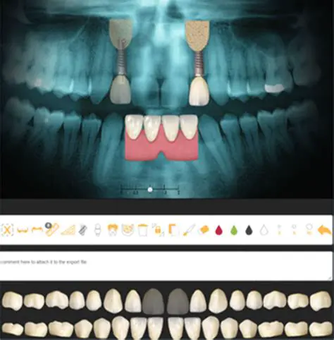 Key Features of DentalMaster D2D