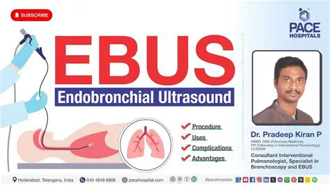 Key Features of EBuS Software