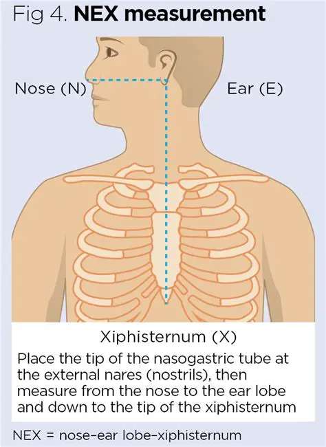 Measure the length of the NG tube from the tip of the nose to the lobe of the ear