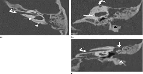 Observation of External Malformations