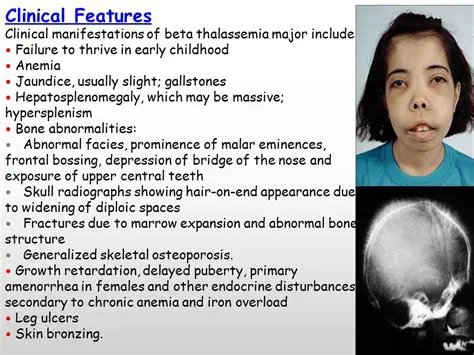 The Impact of Thalassemia Major on Sufferers and Their Families